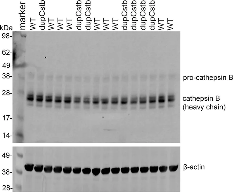 Western blot - Anti-Cathepsin B antibody [EPR21033] (AB214428)