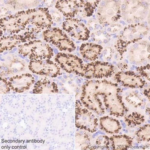 Immunohistochemistry (Formalin/PFA-fixed paraffin-embedded sections) - Anti-Cathepsin B antibody [EPR21033] - BSA and Azide free (AB227811)