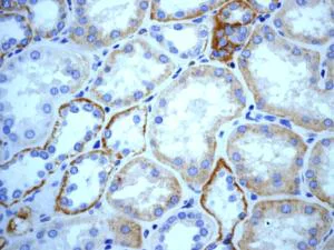 Immunohistochemistry (Formalin/PFA-fixed paraffin-embedded sections) - Anti-Cathepsin B antibody [EPR4323] (AB125067)