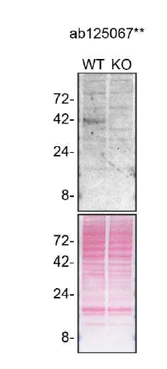 Western blot - Anti-Cathepsin B antibody [EPR4323] (AB125067)