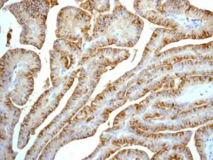 Immunohistochemistry (Formalin/PFA-fixed paraffin-embedded sections) - Anti-Cathepsin B antibody [EPR4323] - BSA and Azide free (AB230401)