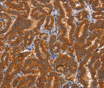 Immunohistochemistry (Formalin/PFA-fixed paraffin-embedded sections) - Anti-Cathepsin C antibody (AB199109)