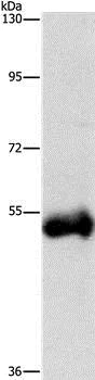 Western blot - Anti-Cathepsin C antibody (AB199109)