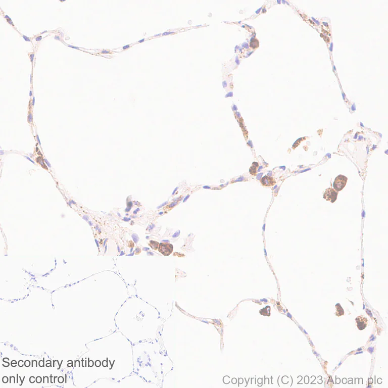 Immunohistochemistry (Formalin/PFA-fixed paraffin-embedded sections) - Anti-Cathepsin C antibody [EPR26636-76] (AB314644)