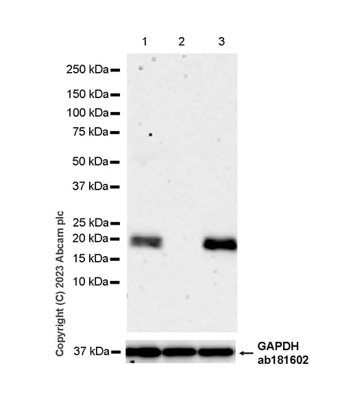 Western blot - Anti-Cathepsin C antibody [EPR26636-76] (AB314644)