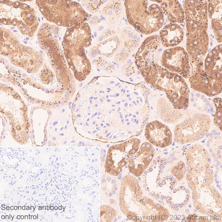 Immunohistochemistry (Formalin/PFA-fixed paraffin-embedded sections) - Anti-Cathepsin C antibody [EPR26636-76] - BSA and Azide free (AB314645)