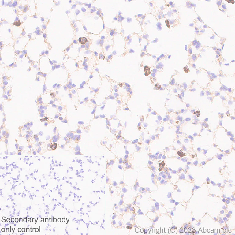 Immunohistochemistry (Formalin/PFA-fixed paraffin-embedded sections) - Anti-Cathepsin C antibody [EPR26636-76] - BSA and Azide free (AB314645)