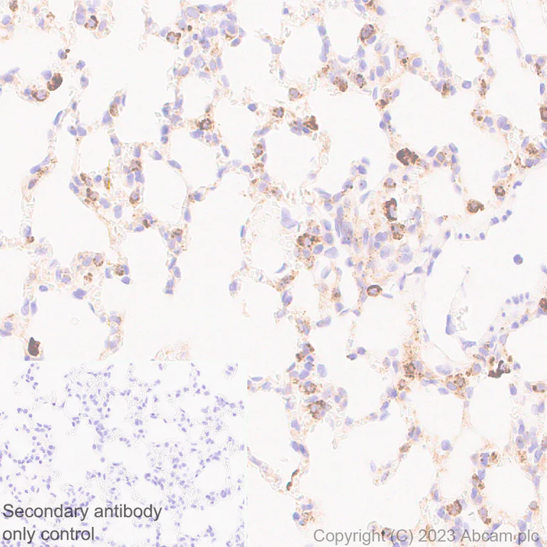 Immunohistochemistry (Formalin/PFA-fixed paraffin-embedded sections) - Anti-Cathepsin C antibody [EPR26636-76] - BSA and Azide free (AB314645)