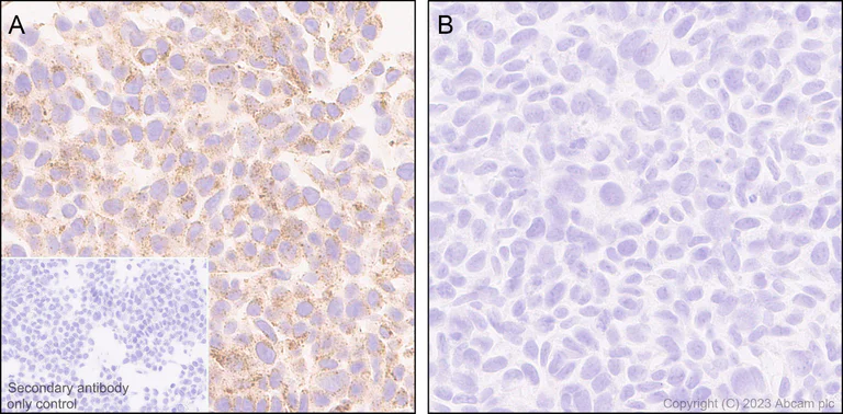 Immunohistochemistry (Formalin/PFA-fixed paraffin-embedded sections) - Anti-Cathepsin C antibody [EPR26636-76] - BSA and Azide free (AB314645)