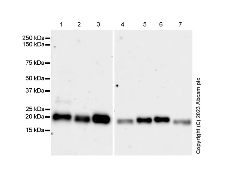 Western blot - Anti-Cathepsin C antibody [EPR26636-76] - BSA and Azide free (AB314645)