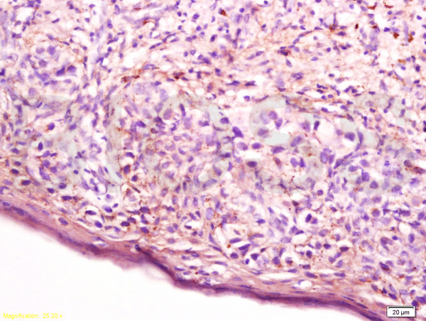 Immunohistochemistry (Formalin/PFA-fixed paraffin-embedded sections) - Anti-Cathepsin D antibody (AB217310)