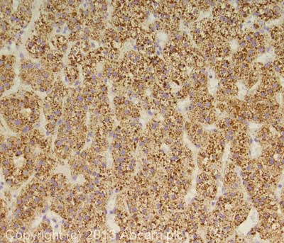Immunohistochemistry (Formalin/PFA-fixed paraffin-embedded sections) - Anti-Cathepsin D antibody (AB72915), expandable thumbnail