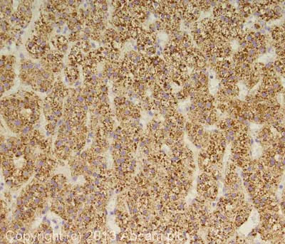 Immunohistochemistry (Formalin/PFA-fixed paraffin-embedded sections) - Anti-Cathepsin D antibody (AB72915)