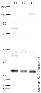 Western blot - Anti-Cathepsin D antibody (AB72915), expandable thumbnail