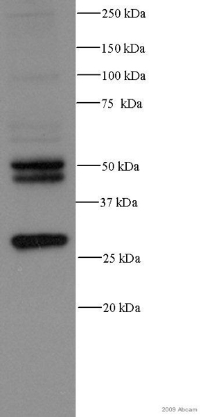 Western blot - Anti-Cathepsin D antibody [CTD-19] (AB6313)