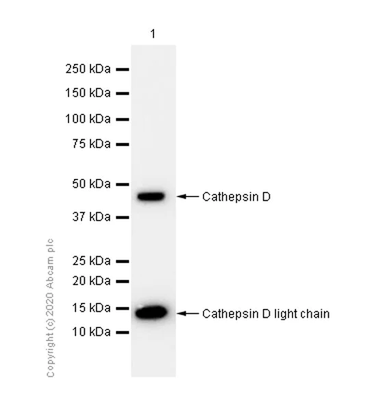 Western blot - Anti-Cathepsin D antibody [EPR3056Y] (AB75811)