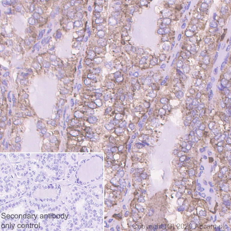 Immunohistochemistry (Formalin/PFA-fixed paraffin-embedded sections) - Anti-Cathepsin D antibody [EPR3056Y] - BSA and Azide free (AB207550)