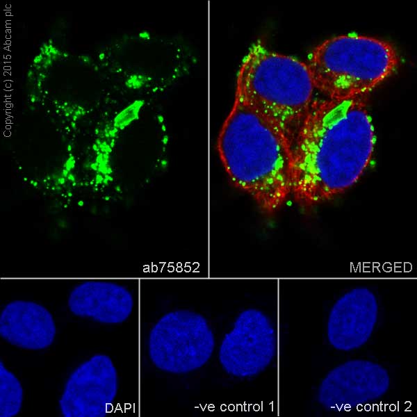 Immunocytochemistry/ Immunofluorescence - Anti-Cathepsin D antibody [EPR3057Y] (ab75852), expandable thumbnail