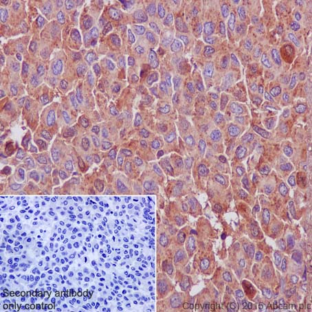 Immunohistochemistry (Formalin/PFA-fixed paraffin-embedded sections) - Anti-Cathepsin D antibody [EPR3057Y] (ab75852), expandable thumbnail