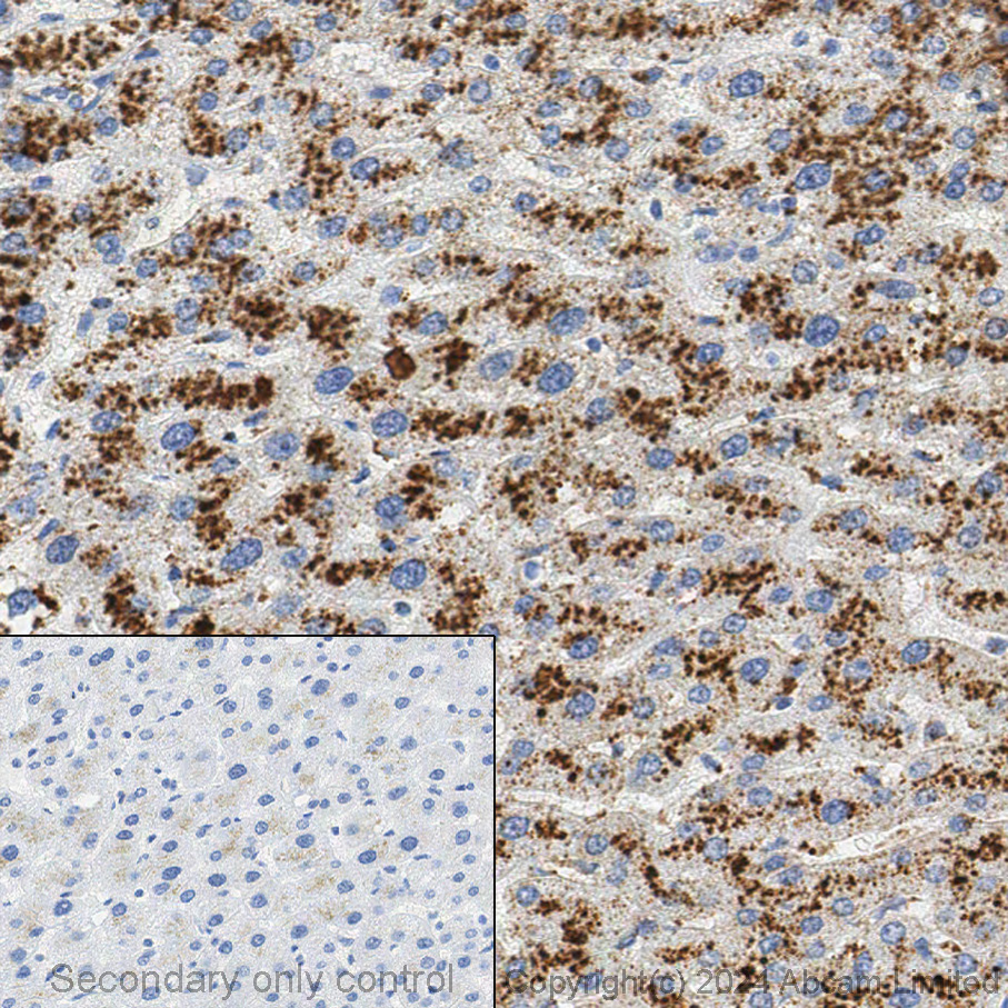 Immunohistochemistry (Formalin/PFA-fixed paraffin-embedded sections) - Anti-Cathepsin D antibody [EPR3057Y] (ab75852), expandable thumbnail