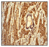 Immunohistochemistry (Formalin/PFA-fixed paraffin-embedded sections) - Anti-Cathepsin D antibody [EPR3057Y] (ab75852), expandable thumbnail