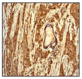 Immunohistochemistry (Formalin/PFA-fixed paraffin-embedded sections) - Anti-Cathepsin D antibody [EPR3057Y] (AB75852)