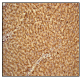 Immunohistochemistry (Formalin/PFA-fixed paraffin-embedded sections) - Anti-Cathepsin D antibody [EPR3057Y] (ab75852), expandable thumbnail