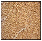 Immunohistochemistry (Formalin/PFA-fixed paraffin-embedded sections) - Anti-Cathepsin D antibody [EPR3057Y] (AB75852)