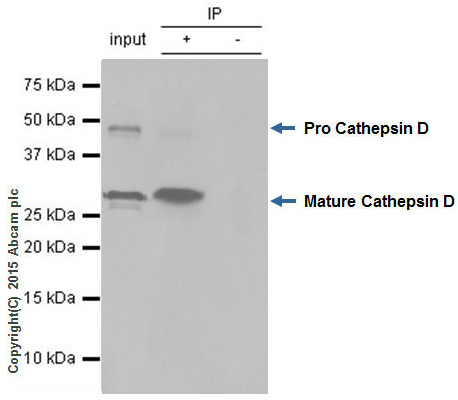Immunoprecipitation - Anti-Cathepsin D antibody [EPR3057Y] (AB75852), expandable thumbnail