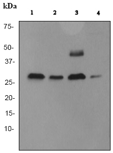 Western blot - Anti-Cathepsin D antibody [EPR3057Y] (ab75852), expandable thumbnail