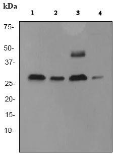 Western blot - Anti-Cathepsin D antibody [EPR3057Y] (AB75852)