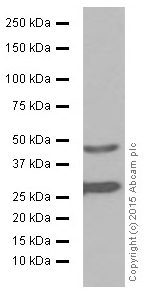 Western blot - Anti-Cathepsin D antibody [EPR3057Y] (AB75852), expandable thumbnail
