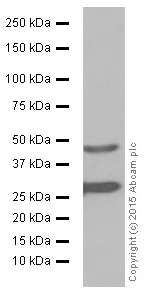 Western blot - Anti-Cathepsin D antibody [EPR3057Y] (AB75852)