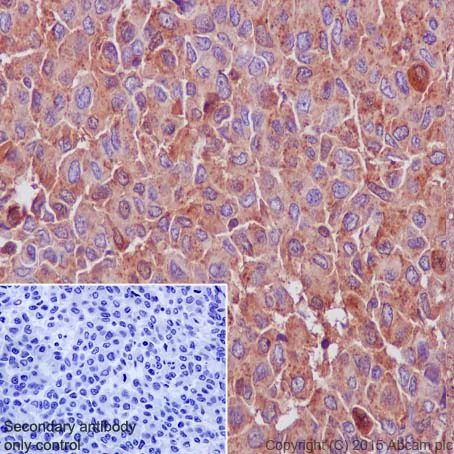 Immunohistochemistry (Formalin/PFA-fixed paraffin-embedded sections) - Anti-Cathepsin D antibody [EPR3057Y] - BSA and Azide free (AB207549)
