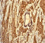 Immunohistochemistry (Formalin/PFA-fixed paraffin-embedded sections) - Anti-Cathepsin D antibody [EPR3057Y] - BSA and Azide free (AB207549)