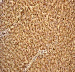 Immunohistochemistry (Formalin/PFA-fixed paraffin-embedded sections) - Anti-Cathepsin D antibody [EPR3057Y] - BSA and Azide free (AB207549)