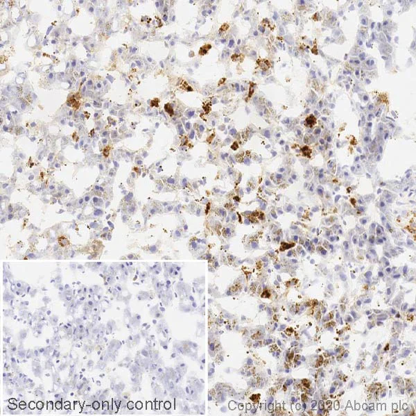 Immunohistochemistry (Frozen sections) - Anti-Cathepsin D antibody [EPR3057Y] - BSA and Azide free (AB207549)