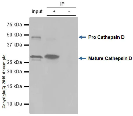 Immunoprecipitation - Anti-Cathepsin D antibody [EPR3057Y] - BSA and Azide free (AB207549)