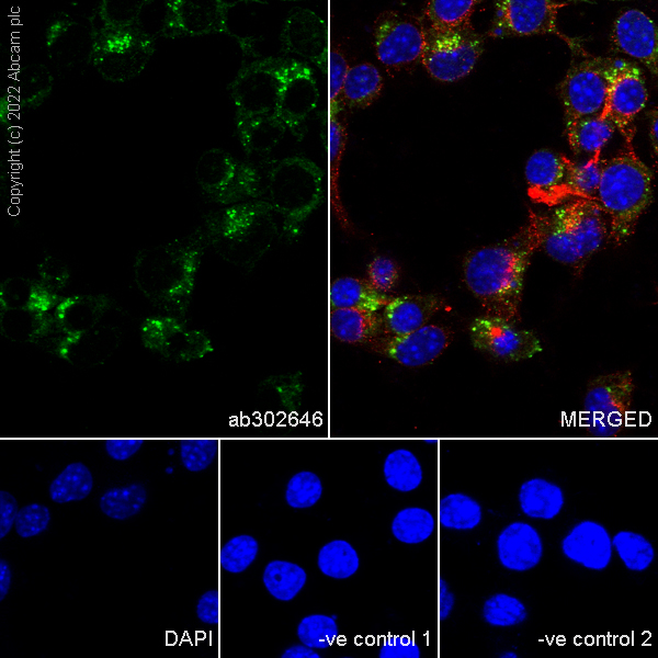Immunocytochemistry/ Immunofluorescence - Anti-Cathepsin D antibody [EPR3057Y] - Chicken IgY (Chimeric) (AB302646), expandable thumbnail