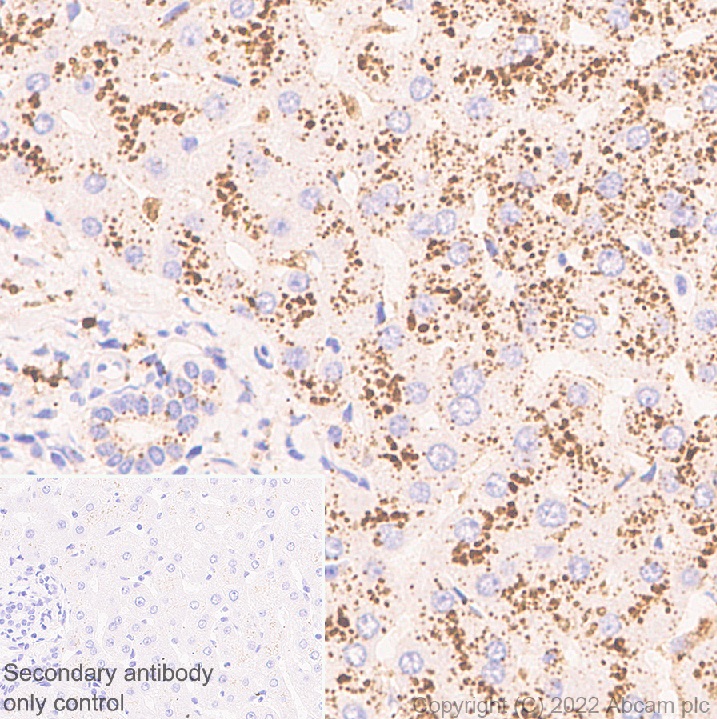 Immunohistochemistry (Formalin/PFA-fixed paraffin-embedded sections) - Anti-Cathepsin D antibody [EPR3057Y] - Chicken IgY (Chimeric) (AB302646), expandable thumbnail