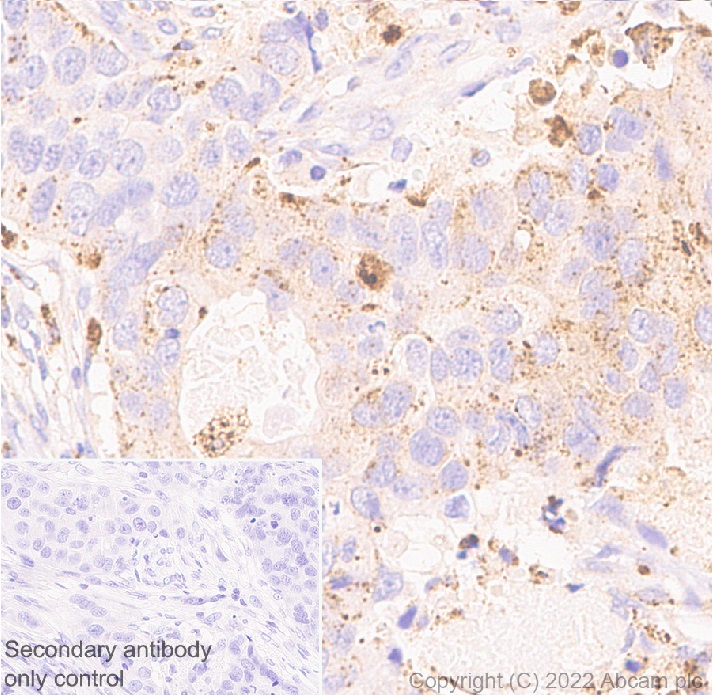 Immunohistochemistry (Formalin/PFA-fixed paraffin-embedded sections) - Anti-Cathepsin D antibody [EPR3057Y] - Chicken IgY (Chimeric) (AB302646), expandable thumbnail
