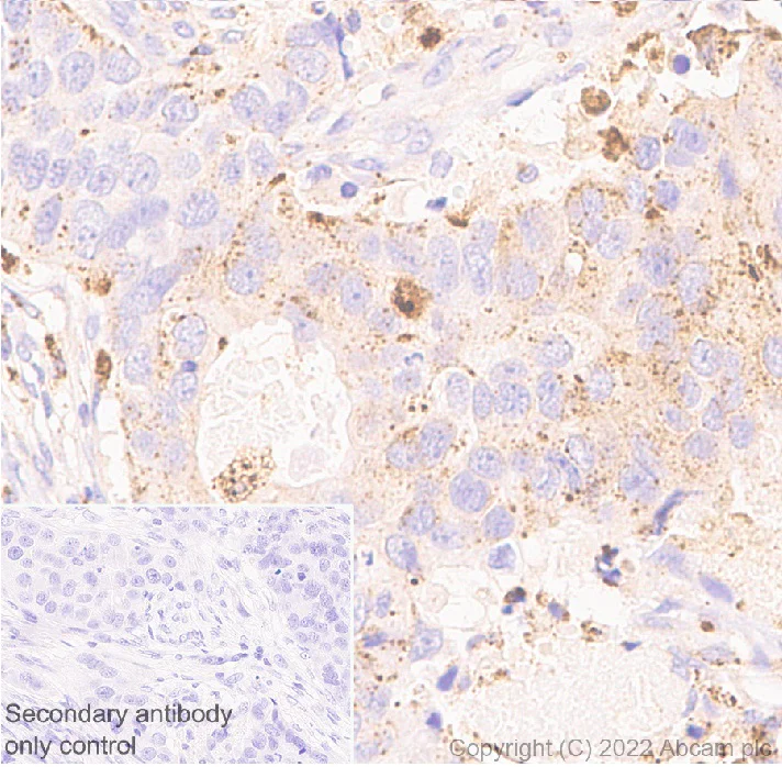 Immunohistochemistry (Formalin/PFA-fixed paraffin-embedded sections) - Anti-Cathepsin D antibody [EPR3057Y] - Chicken IgY (Chimeric) (AB302646)
