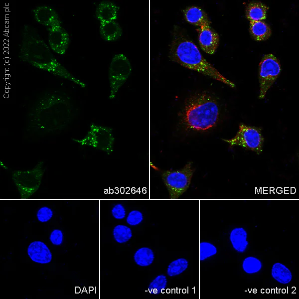 Immunocytochemistry/ Immunofluorescence - Anti-Cathepsin D antibody [EPR3057Y] - Chicken IgY (Chimeric) - BSA and Azide free (AB302647)