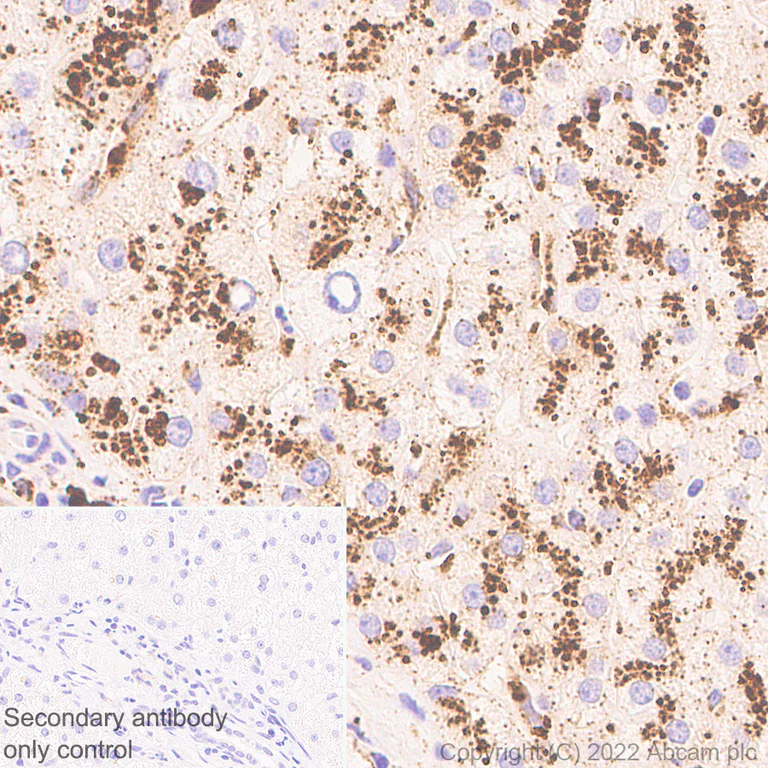 Immunohistochemistry (Formalin/PFA-fixed paraffin-embedded sections) - Anti-Cathepsin D [EPR3057Y] - Mouse IgG2a (Chimeric) - BSA and Azide free (AB302650)