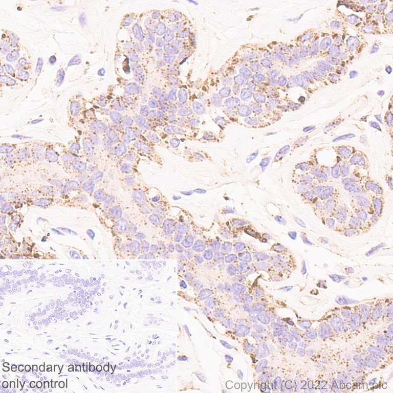 Immunohistochemistry (Formalin/PFA-fixed paraffin-embedded sections) - Anti-Cathepsin D [EPR3057Y] - Mouse IgG2a (Chimeric) - BSA and Azide free (AB302650)