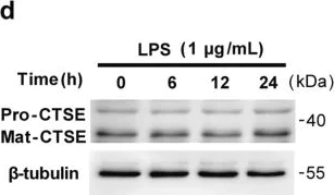 Western blot - Anti-Cathepsin E antibody (AB36996)