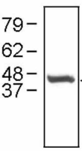Western blot - Anti-Cathepsin E antibody (AB36996)