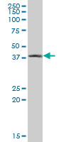 Western blot - Anti-Cathepsin E antibody (AB89414)