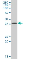 Western blot - Anti-Cathepsin E antibody (AB89414)