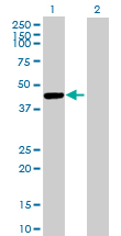 Western blot - Anti-Cathepsin E antibody (AB89414)